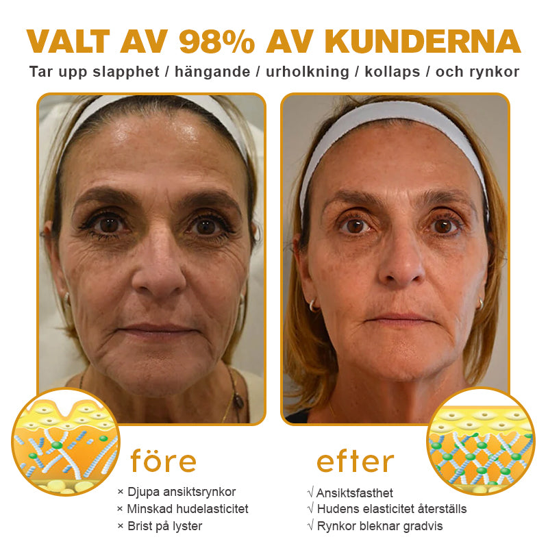 🐬💎Tillverkad och skickad från Sverige✅Furzero™ Botox Bee Venom Wrinkle Removal Cream - Sista Dagen-kampanj 70 % RABATT