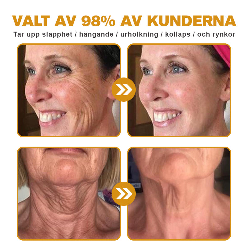 🐬💎Tillverkad och skickad från Sverige✅Furzero™ Botox Bee Venom Wrinkle Removal Cream - Sista Dagen-kampanj 70 % RABATT